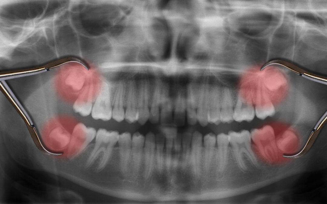 dental